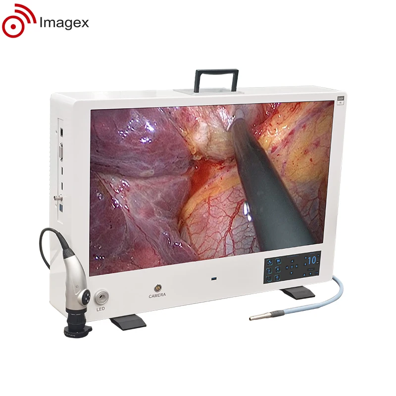 2K 4K Compact integrated Endoscopy camera system for endoscopic surgery