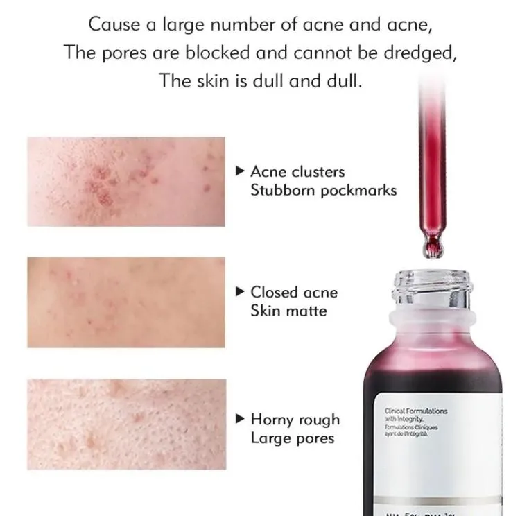 OEM ODM Skin Care Low MOQ Face Serum AHA BHA Niacinamide Zinc Hyaluronic Acid B5 Retinol Facial Serum Caffeine EGCG Eye Serum