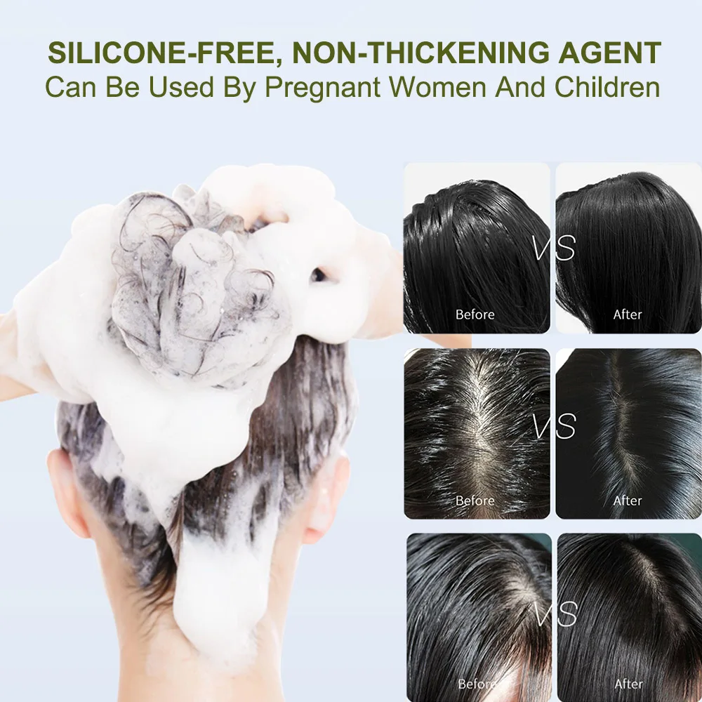 Shampoo Hair Care Anti-Loss Control Oil 100% Natural Amino Acid Ginger Baby And Pregnant Shampoo And Conditioner Hair Care Sets