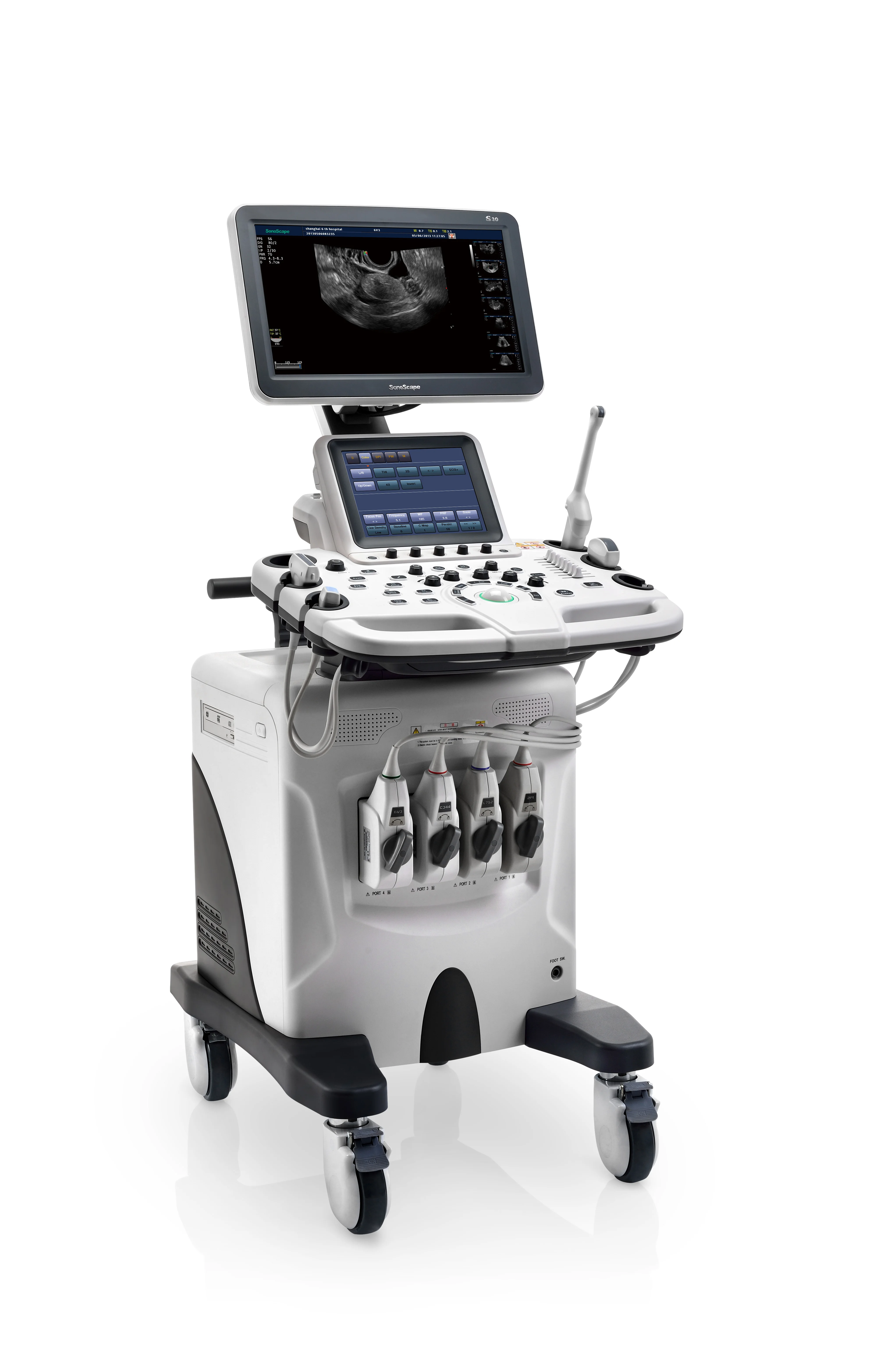 Best Price for Trolley Color Doppler 3D/4D SonoScape S30 with advanced technology