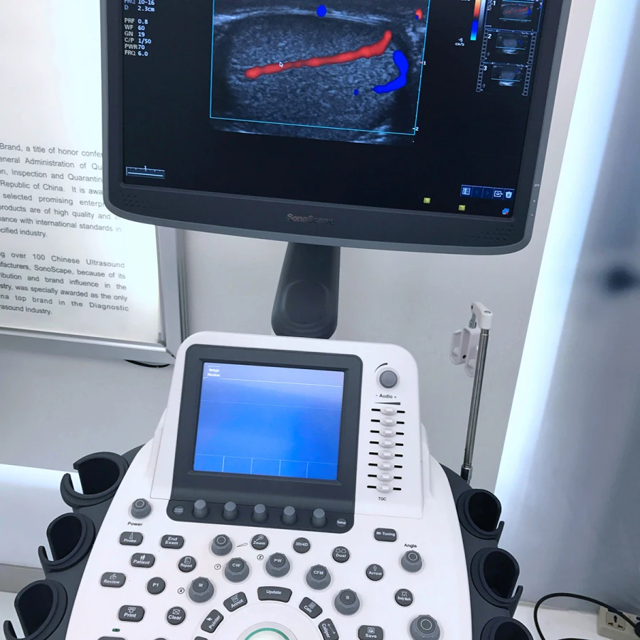 High- Quality S22 SonoScape Ultrasound 3D&4D