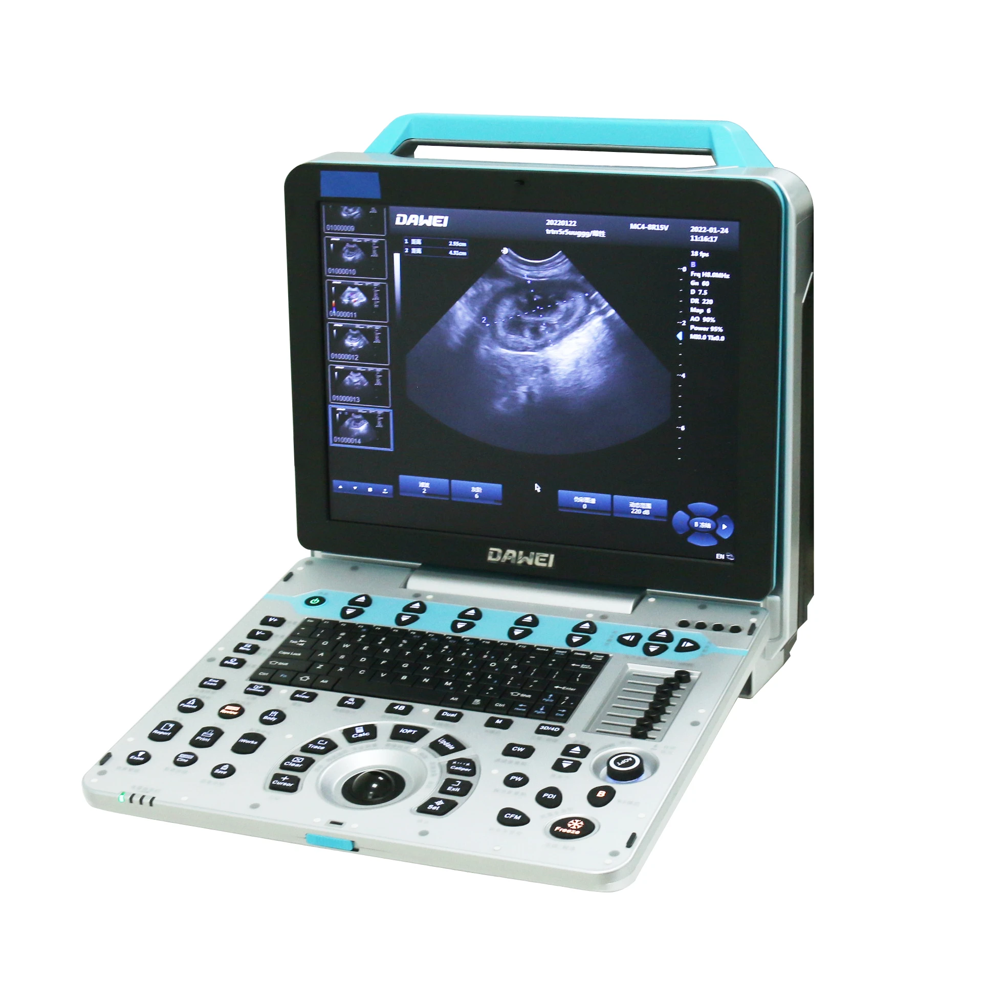Dawei Veterinary Equipment Vet Full Digital Portable Ultrasound Scanner Machine For Animal
