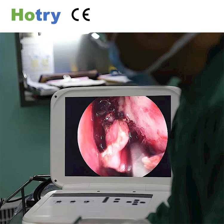 
Surgical endoscope FHD (display + camera system + handle) endoscopy camera system neurosurgery ent 