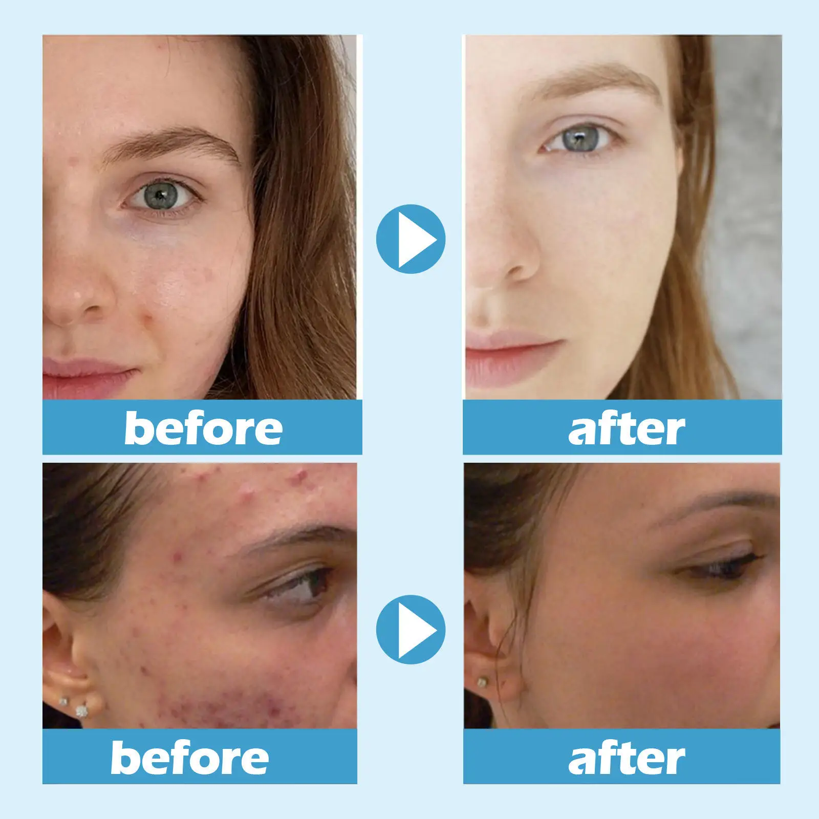 Facial Mask vitamin e  skin hydrating soothing lifting pore minimizing dark spots repairing ice water sleeping mask