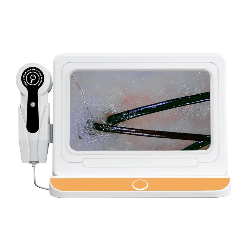 Portable HD Scalp Hair Follicles Scanner Detector Hair Analyzer Skin And Scalp Hair Analysis Machine