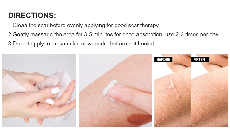 Skin waterproof  Silicone scar  Patch Remove Sheet Silicone Gel Scar Tape Scar Removal Sheet