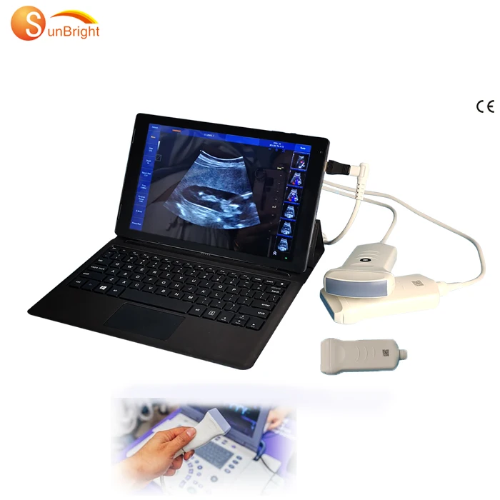 Портативный Цветной Допплер ультразвуковая машина диагностический аппарат линейный USB ультразвуковой