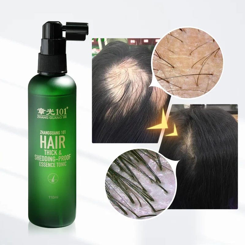 Private Label Castor Oil Extracts Hair Care Hair Growth Serum Spray