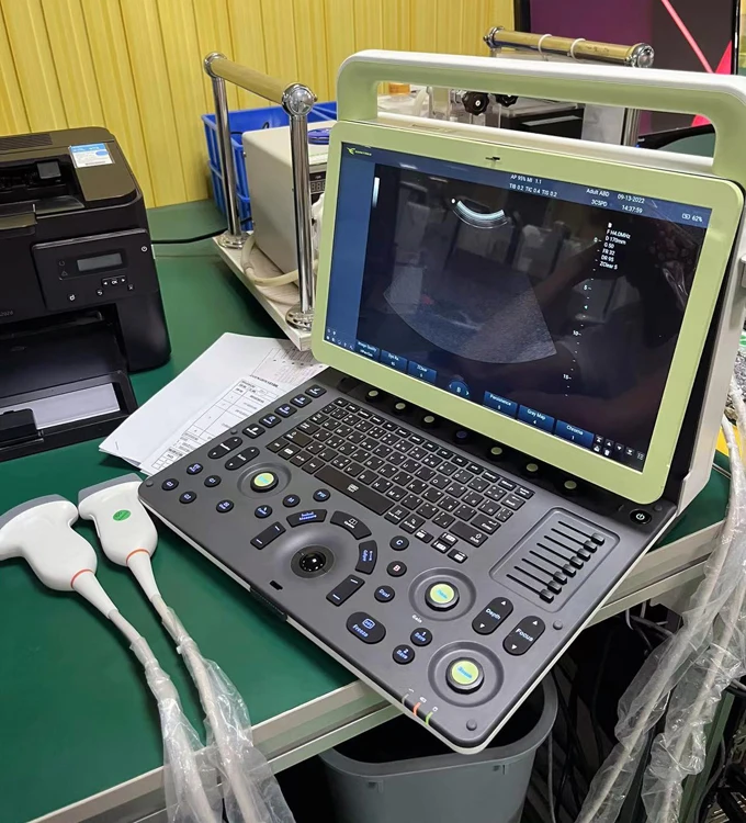 15.6 Inch Portable Color Doppler System Medical 4D Ultrasound Machine for Pregnancy