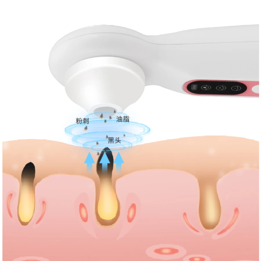 latest trend hot sales visible electric blackhead remover vaccum