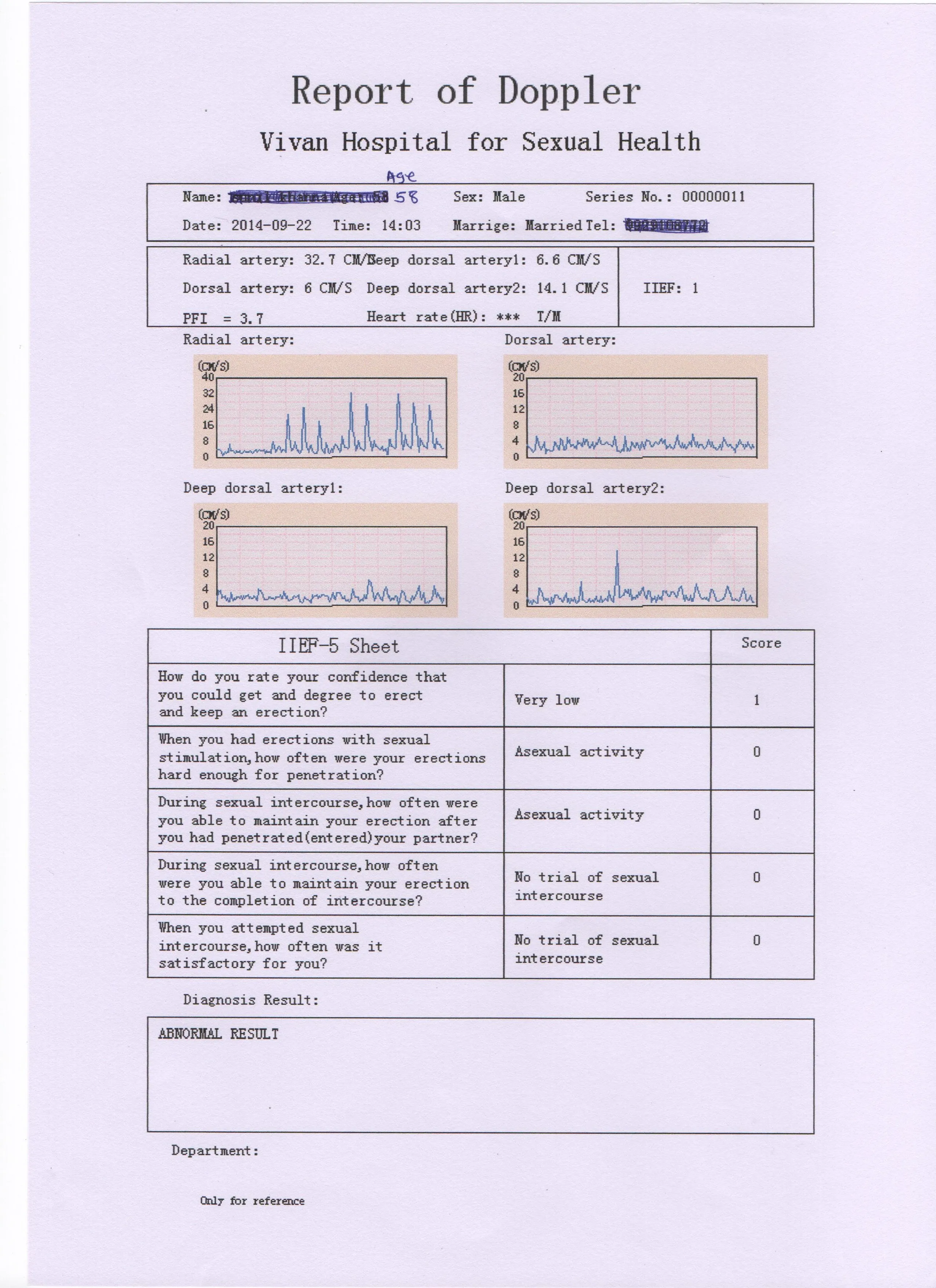 SW-3603 Male Sexual Dysfunction Diagnostic Apparatus / Reproductive Health Equipment