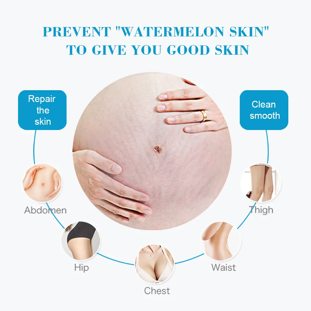 
Hot Sale Suitable All Skin Types Stretch Marks Removal Cream Stretch Mark 