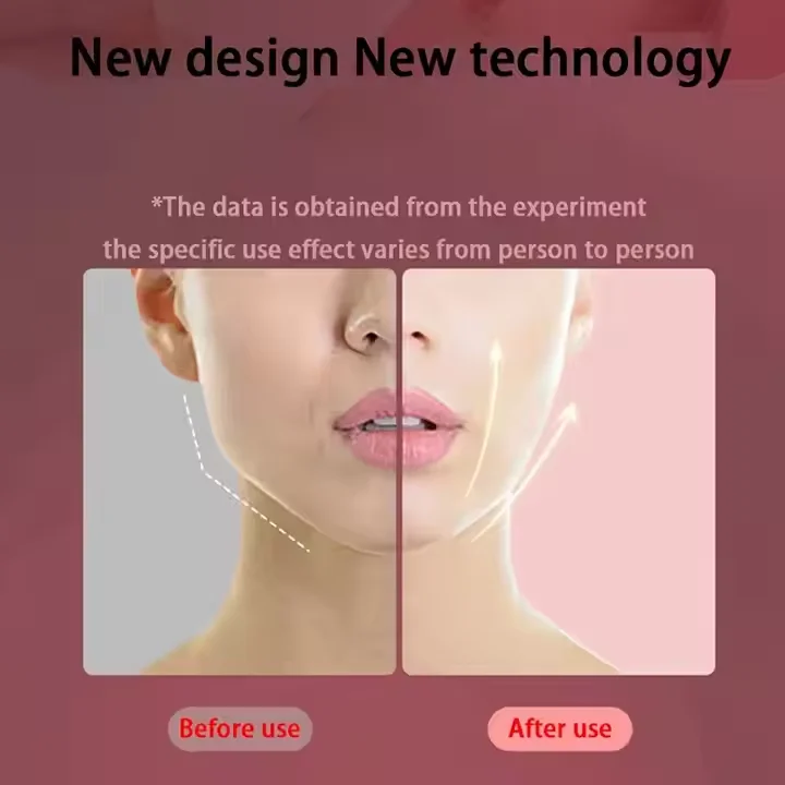 ABS Electric V-Face LED Beauty Device Double Chin Massager with EMS Vibration for Facial Firming & Face Lifting USB Plug Type