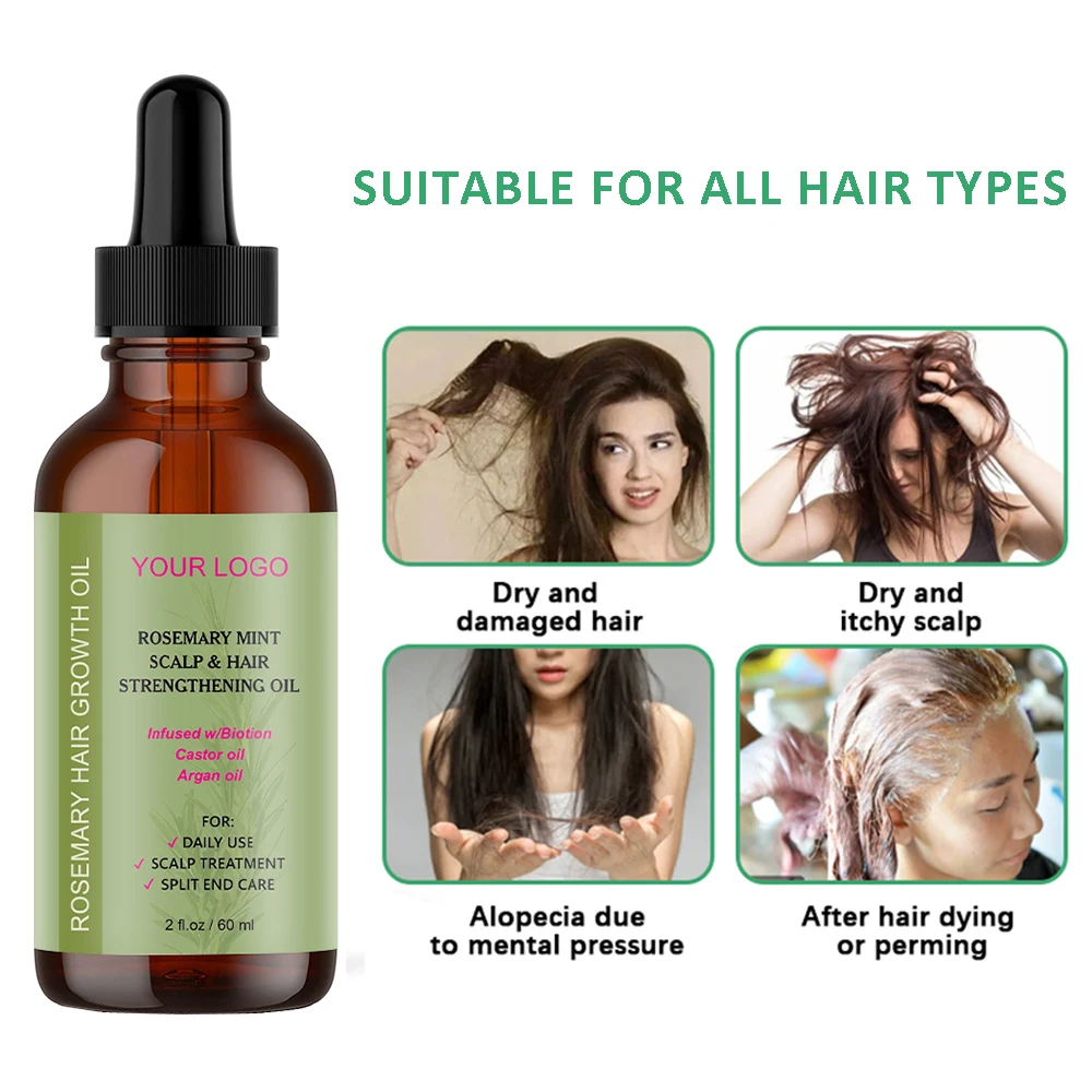 Organic Lavender Rosemary Fast Hair Growth oil for African Alopecia Regrowth Mint Serum for Black Women Hair Loss Product