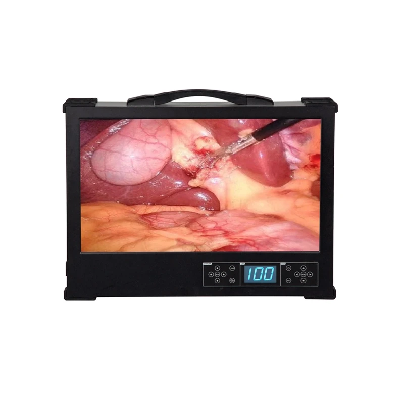 HD390 Integrated Medical 4K Portable Ureteroscopy ENT Endoscope Camera System