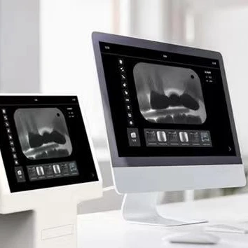 Dental imaging phosphor plate scanner/ Dental Digitalized intraoral Imaging Plate X ray Film Scanner