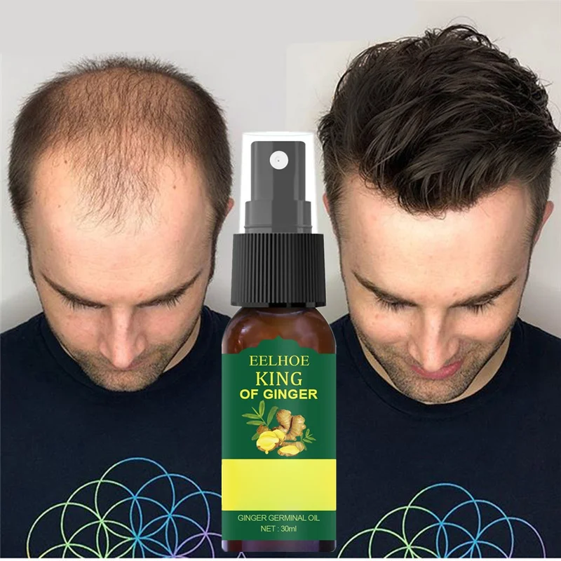 Anti Loss Itching Scalp Elixirs Herbal Instant Hair Growth Products Spray Oil For Black Women Private Label