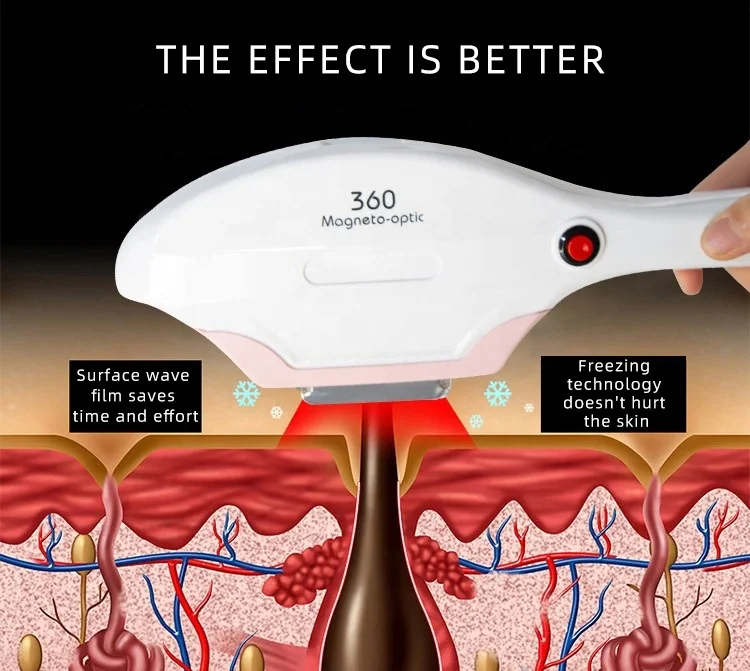 Hot Sale 4 in 1 IPL Picosecond Laser Hair Removal Machine