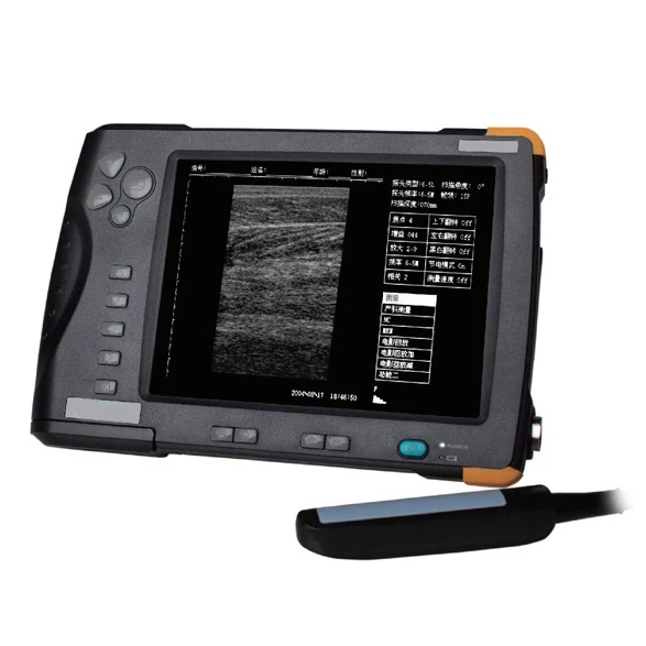 
KBW-V5 Palm Ultrasound Scanner(ultrasonicblack whiteImaging System) 