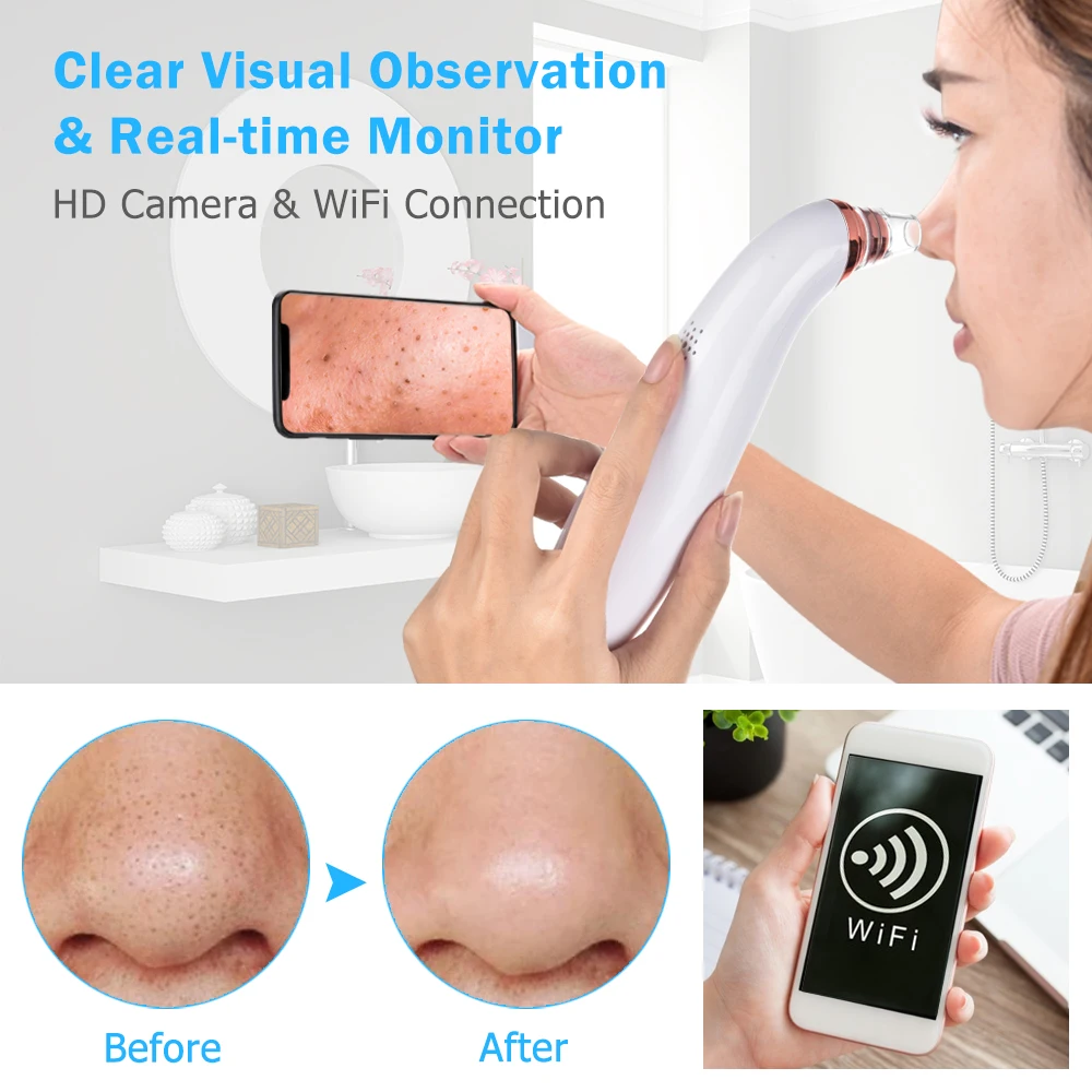 2020 New Wireless Visual Whitehead Bestope Suction Set Nose Device Blackhead Remover Vacuum With Camera Wifi
