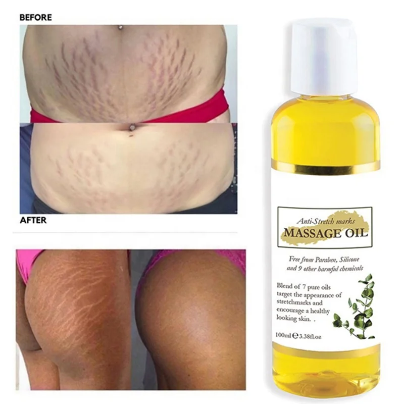 100ml Private Label Stretch Mark Scar Oil Vitamin E & Collagen Skin Firming Body Oil Stretch Mark Removal Oil