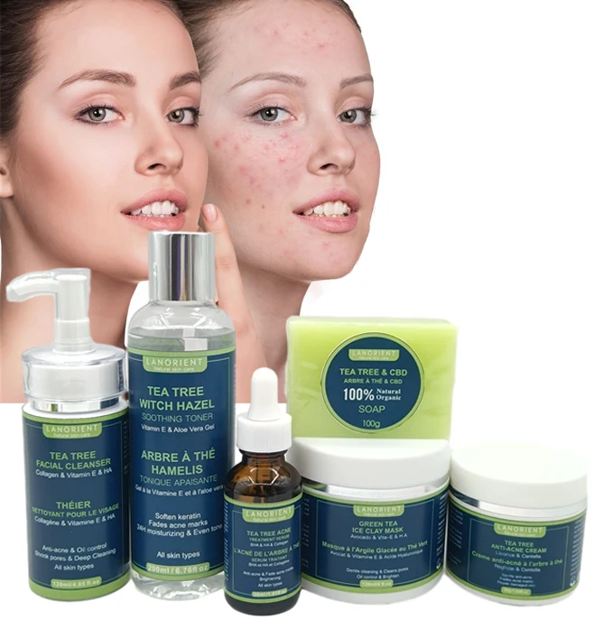 OEM Facial Remove Acne Treatment Skin Care Kit Deep Cleansing Moisturizer Green Tea Tree Anti Acne Skin Care Set