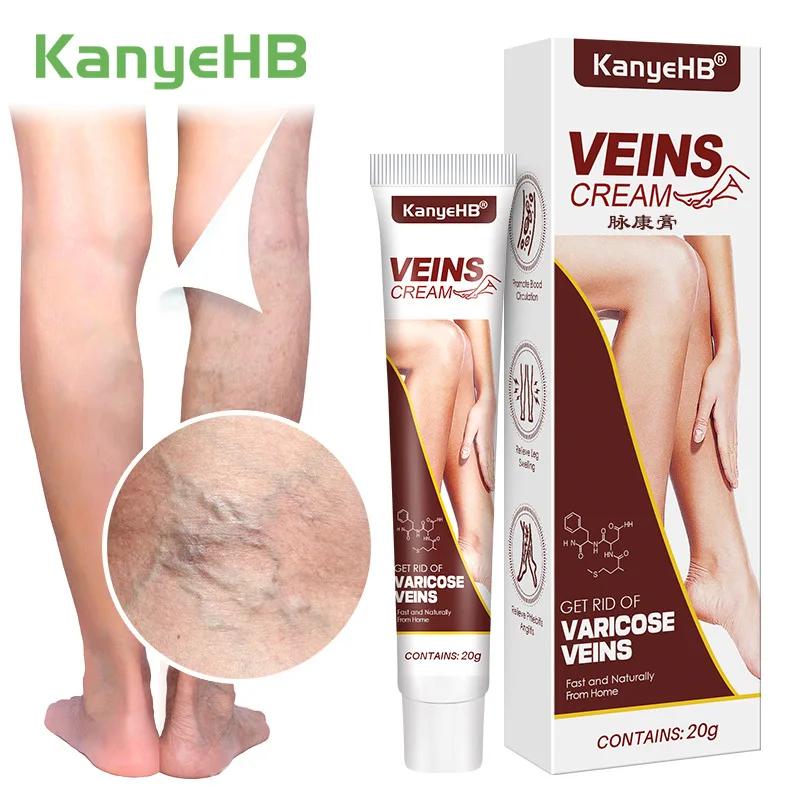 Kanyehb Oem Varicose Veins Cream Vasculitis Phlebitis Spider Ointment Plaster Body Care Odm