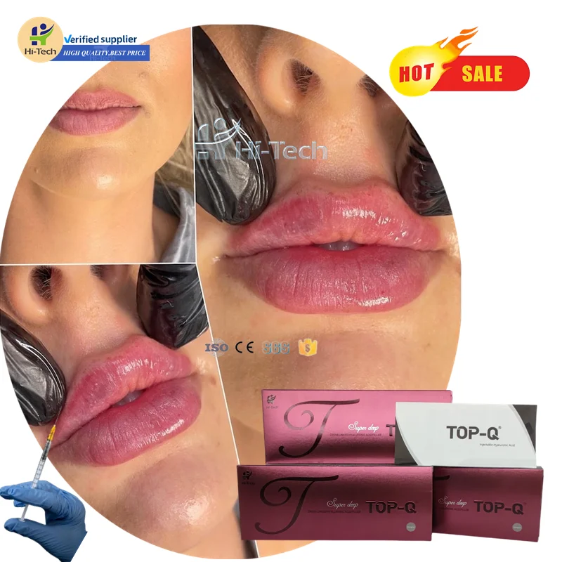 manufacturer wholesale Derm 1ml 2ml body lips filling beauty wrinkle acido hyaluroinic acid dermal filler