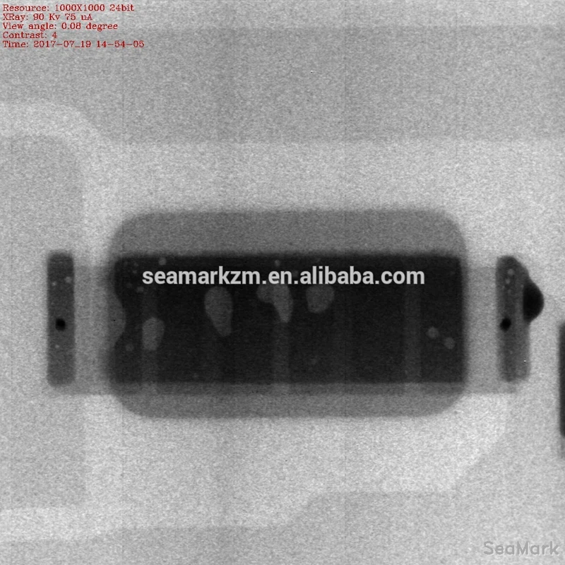Seamark X6600 Digital X-Ray Equipment Machine Prices Bangladesh