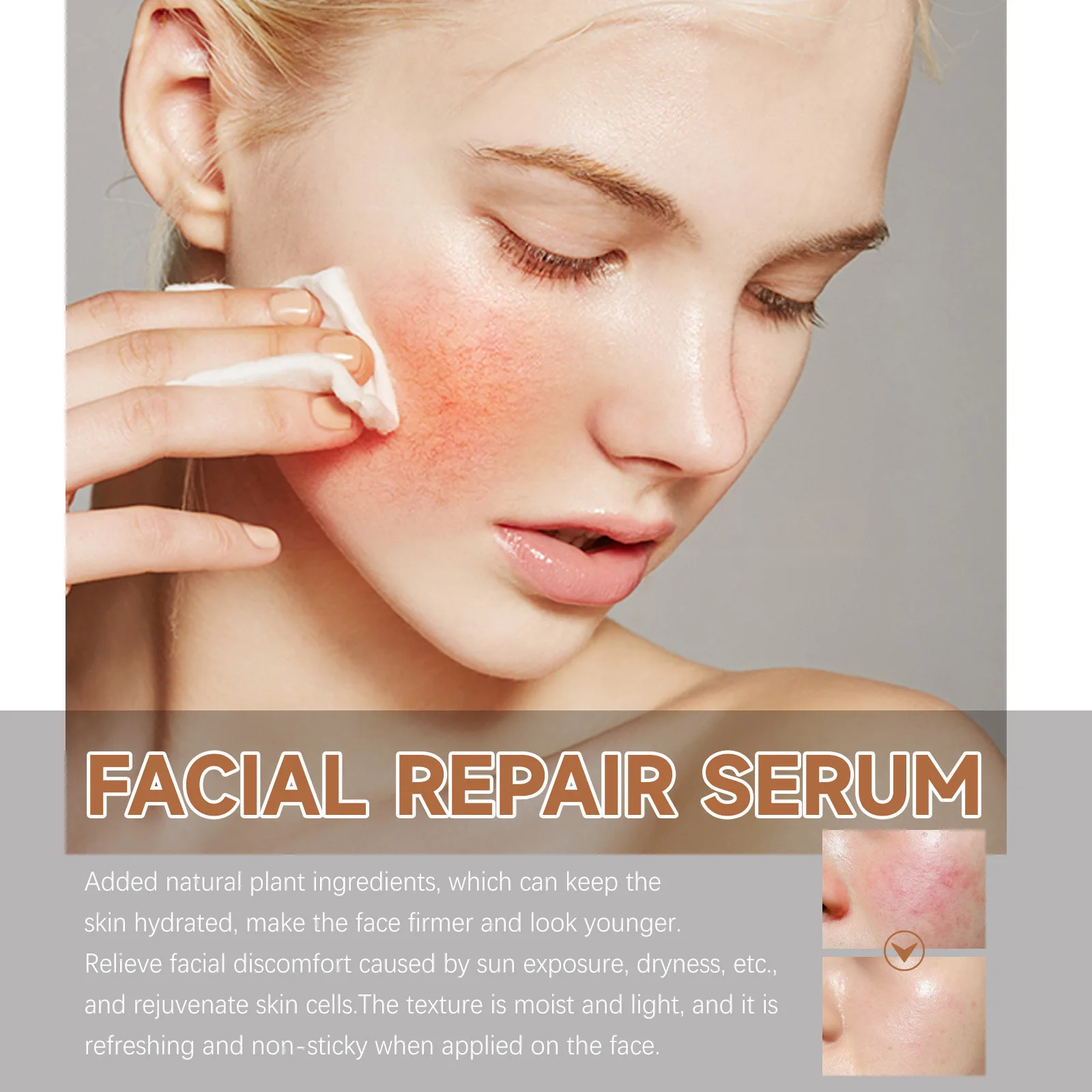 Hot-selling Anti-aging  Firm the facial ski Fade fine lines Nasolabial folds and wrinkles