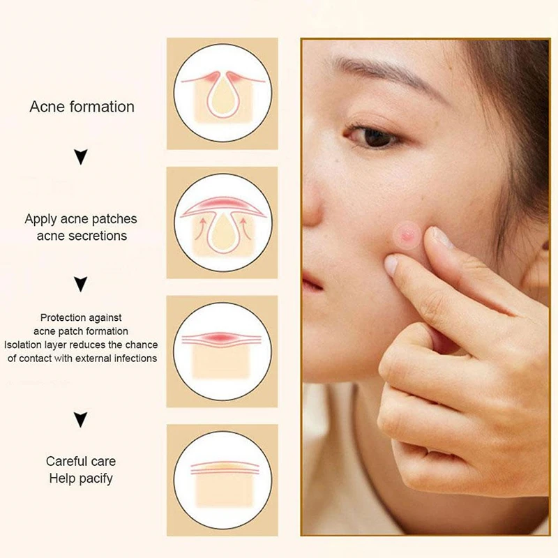 Anthrive Vegan Acne Pimple Healing Patch Hydrocolloid With Tea Tree Oil Acne Pimple Patch For Covering Zits And Blemishes