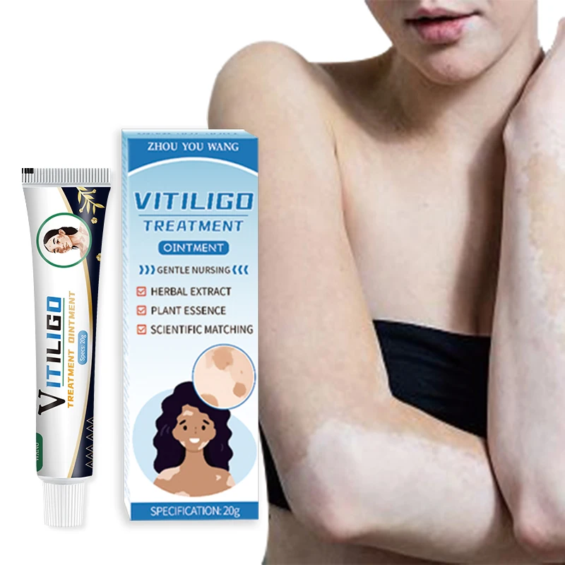 20g vitiligo ointment Body white spots pigmentation skin itchy scars vitiligo