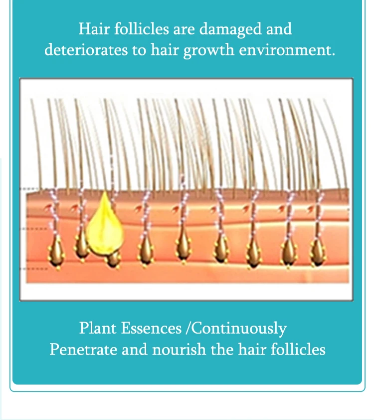 Chinese Supplier Effective Anti Hair Loss Treatment Bulk Hair Serum