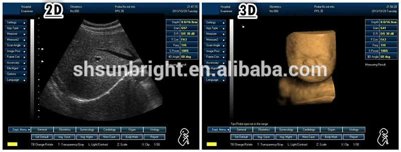 Sunbright CE Medical Echo Echocardiography Full digital laptop gyn OB B ultrasound