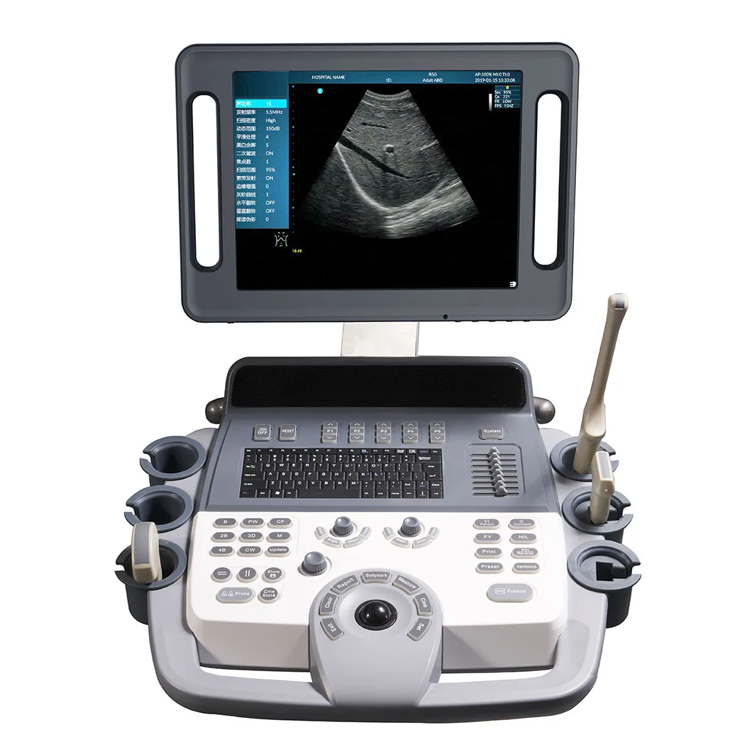 Горячая Распродажа Мобильный аппарат фибросканирования 2D PW THI тележка Цветной Допплер ультразвуковой