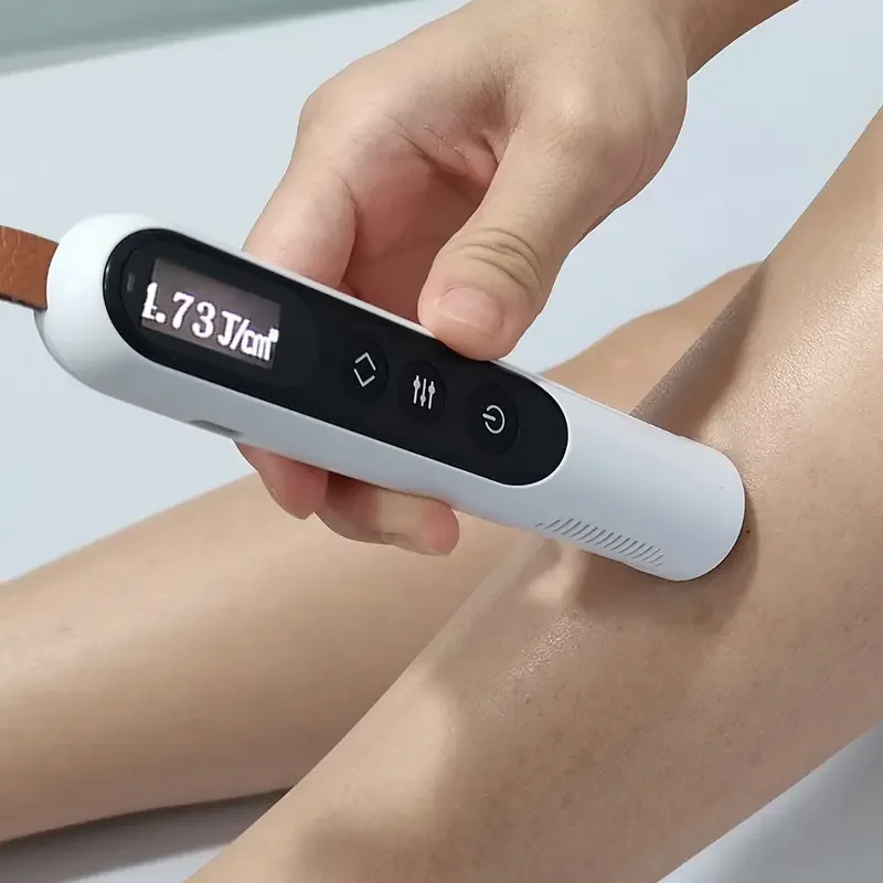 Multifunction Portable Laser Uv Phototherapy Led Excimer Laser Laser Vitiligo Treatment Device Medical Vitiligo Treatment Device