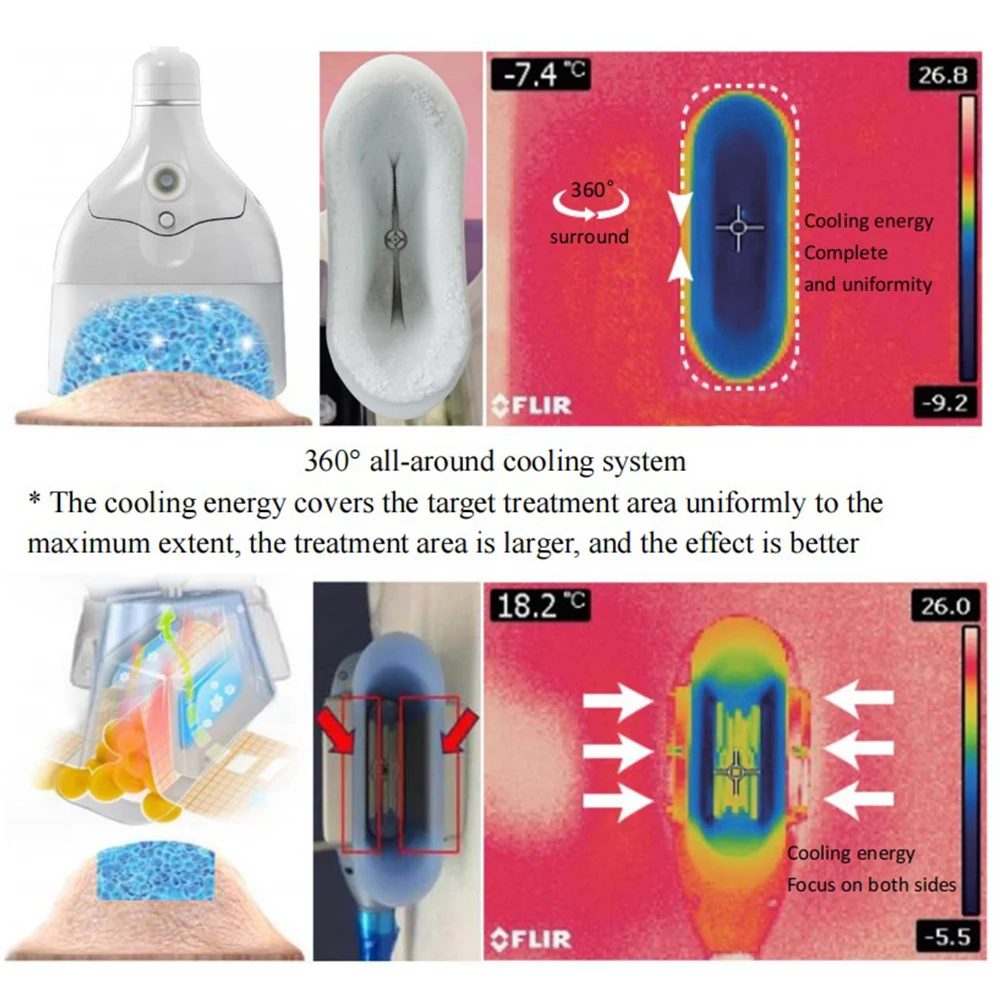 New Trending Fat freezing double chin kryolipolyse slimming machine / kryolipolyse 360