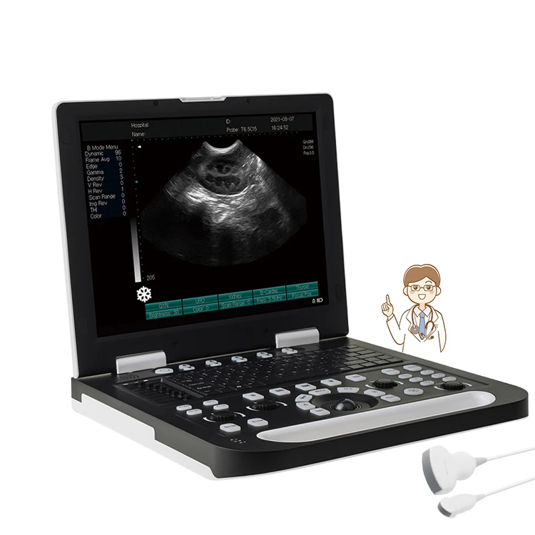 Medical Ultrasound Instruments for Pregnancy N50 Cheap Ultrasound Machine 3d Portable Mini Ultrasound
