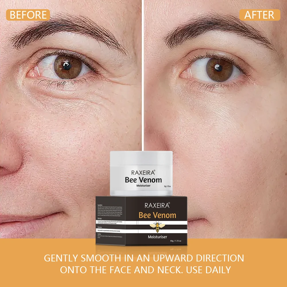 Adult Facial Moisturizer Bee Venom 50g Milk Arbutin Features Sunscreen Whitening Acne Treatment Firming Dark Spot Removal Facial