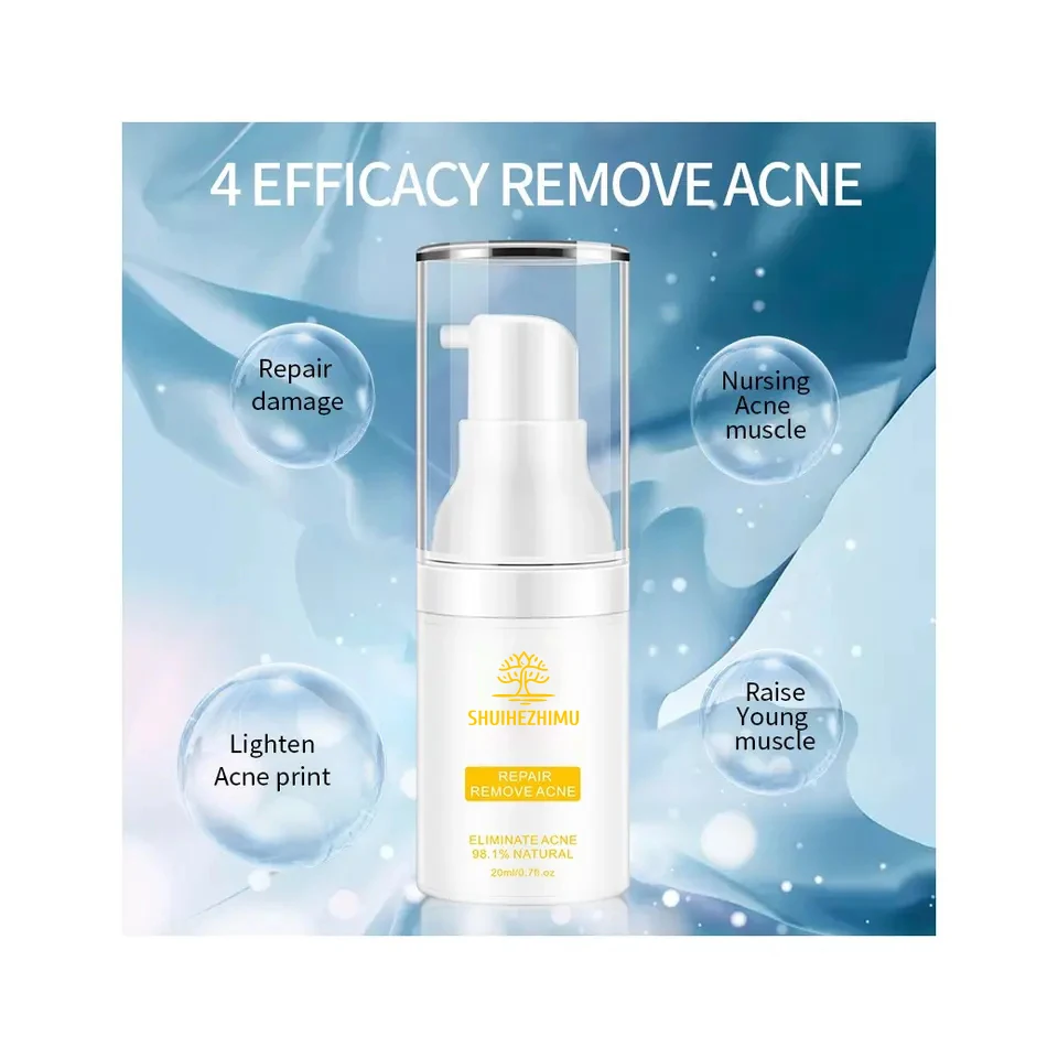 Private Label Anti Acne Cream Organic Herbal Dark Spot Repair Scar Remover Pimple Acne Cream