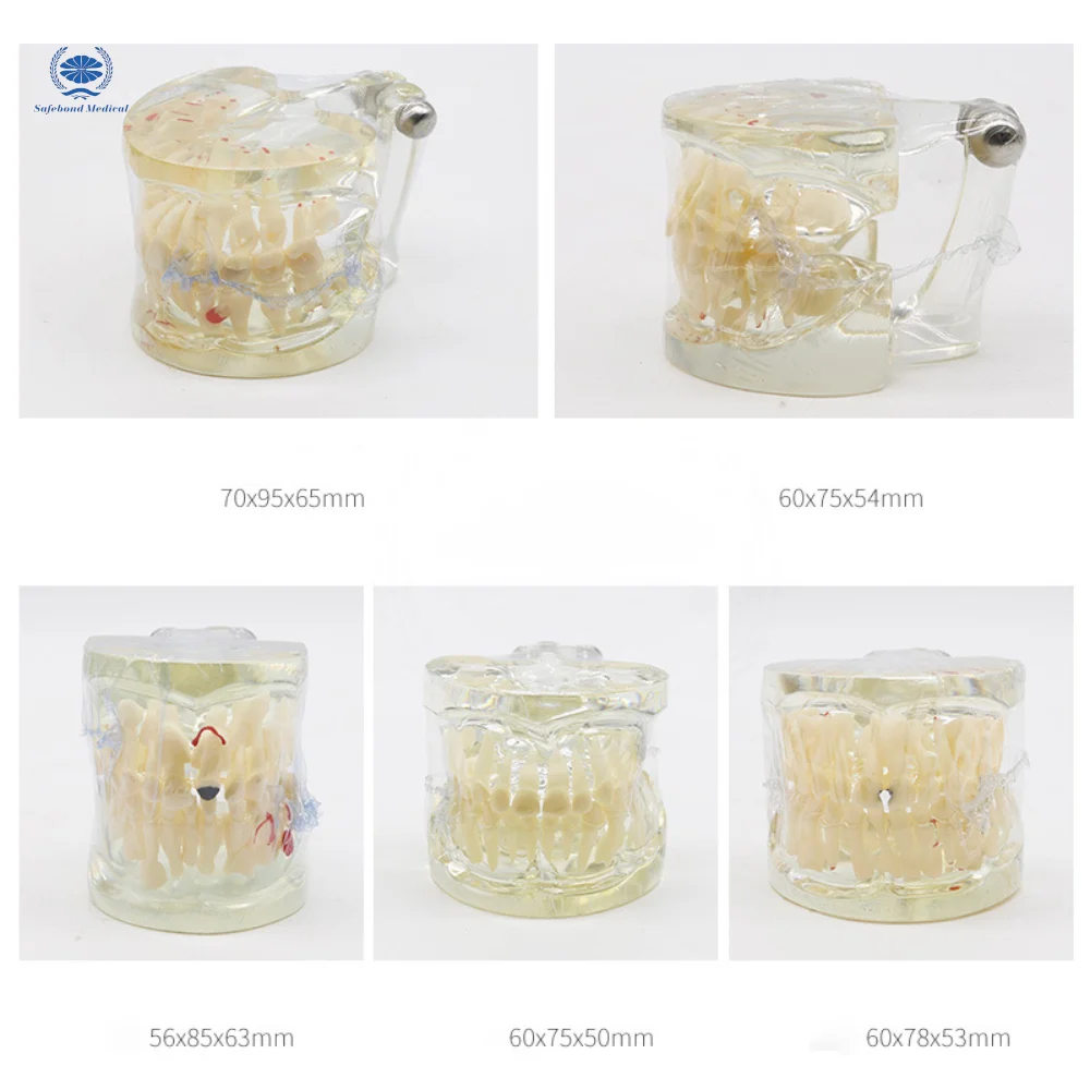 Dental model for medical teaching Dental plastic tooth model