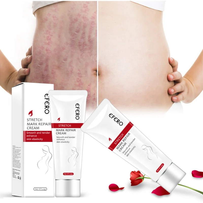 EFERO Postpartum Stretch Mark Cream Removal Scar and Firming Body Stretch Mark Cream