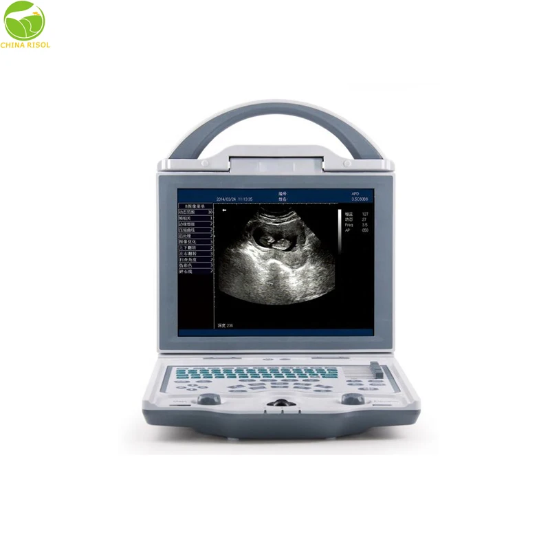 KX5600 Famous model powerful vet ultrasound scanner with 6.5Mhz rectal linear probe for horses and cattle