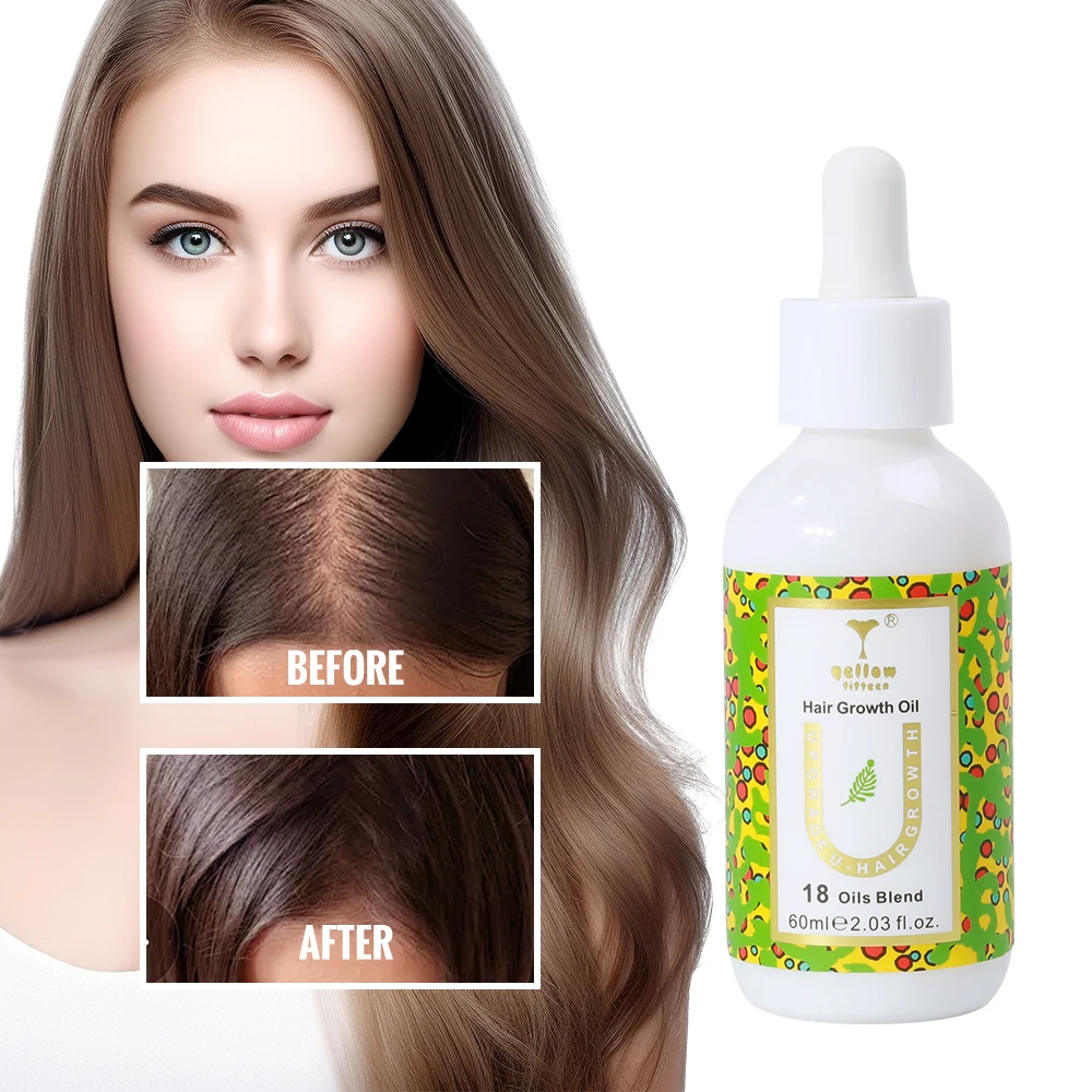 Private Label Wild Fast Biotin Hair Growth Oil Rosemary Biotin Hair Growth Kit Products Serum for Men Natural Hair
