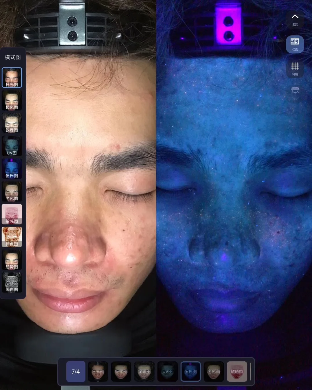DJM Moreme Facial Skin Analysis Machine Instrument Good Comparison Before And After Treatment In Spa & Clinic