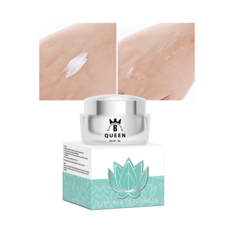 Face Cream Anti Acne Organic Skin Care Set Anti Acne Whitening Acne Remover Cream