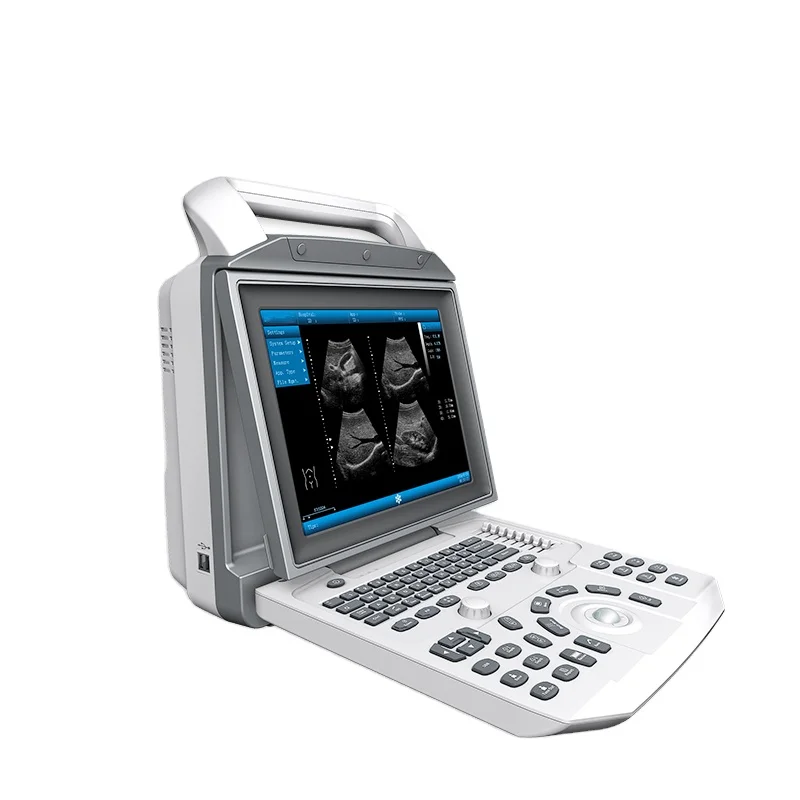 Portable Black and White Ultrasound  manufacturing price  with customization