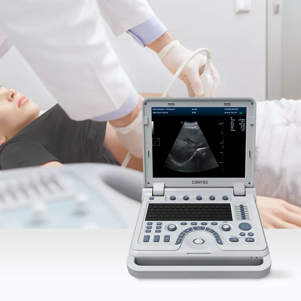 CONTEC CMS1700A  professional medical devices ecografo color doppler ultrasound
