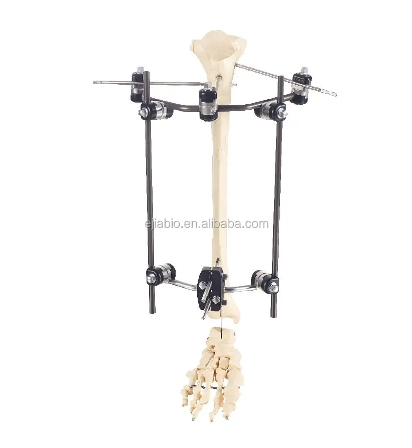 Easy to install Combinational Type of external fixator orthopedic for upper and lower limbs