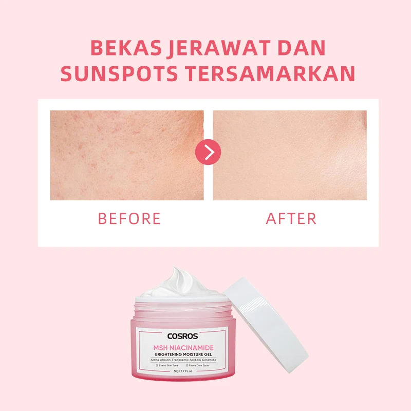 Wholesale Evens Skin Tone Fades Dark Spots Niacinamide Whitening Moisture Gel Cream Alpha Arbutin Tranexamic Acid 5x Ceramide